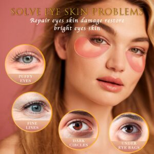 Saimyo Pink Rose Eye Mask - 60 Pieces - Retinol & Collagen Pink Under Eye Mask, Treat Puffy Eyes & Dark Circles, Reduce Wrinkles & Fine Lines, Improve & Firm Undereye Skin, Look Younger